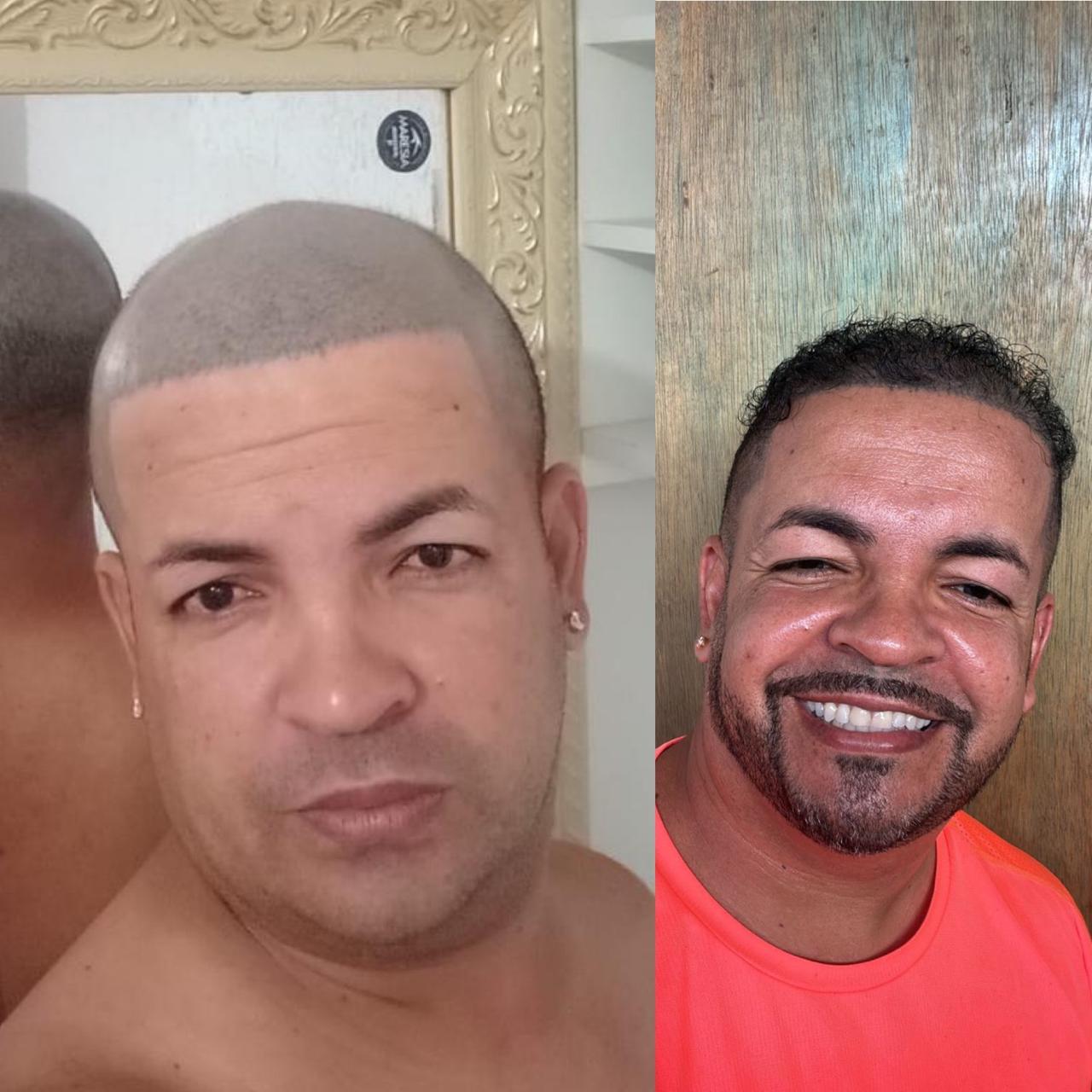 Resultado 9